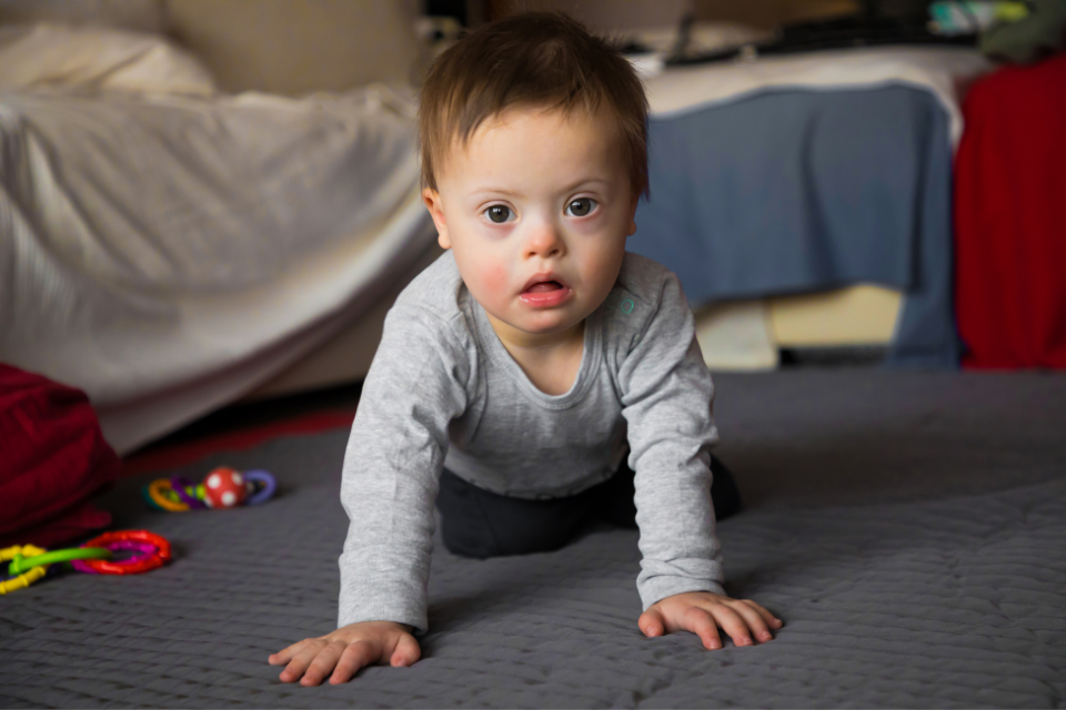 adorable baby boy with down syndrome