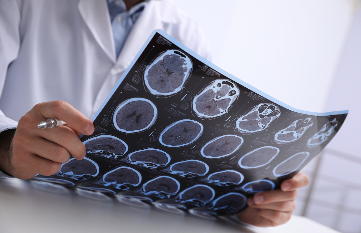 provider holding scans of brain